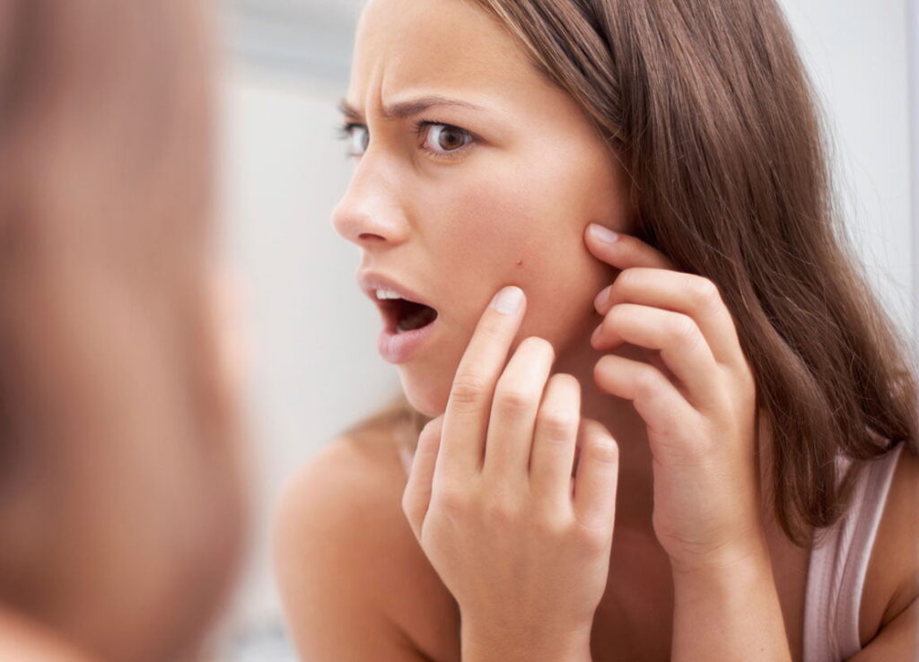 Are Your Hair Follicles to Blame for Breakouts?