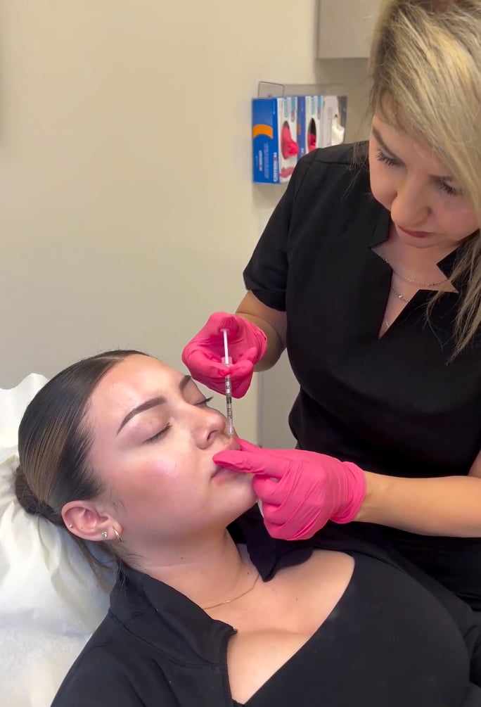 Qualified injector performing lip filler injections at Ahava Medspa in Rancho Cucamonga